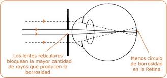 gafas reticulares
