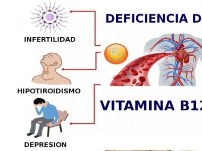 Vegetarianos y la Deficiencia de Vitamina B12